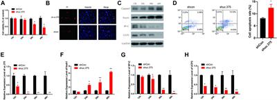 Expression of long noncoding RNA uc.375 in bronchopulmonary dysplasia and its function in the proliferation and apoptosis of mouse alveolar epithelial cell line MLE 12